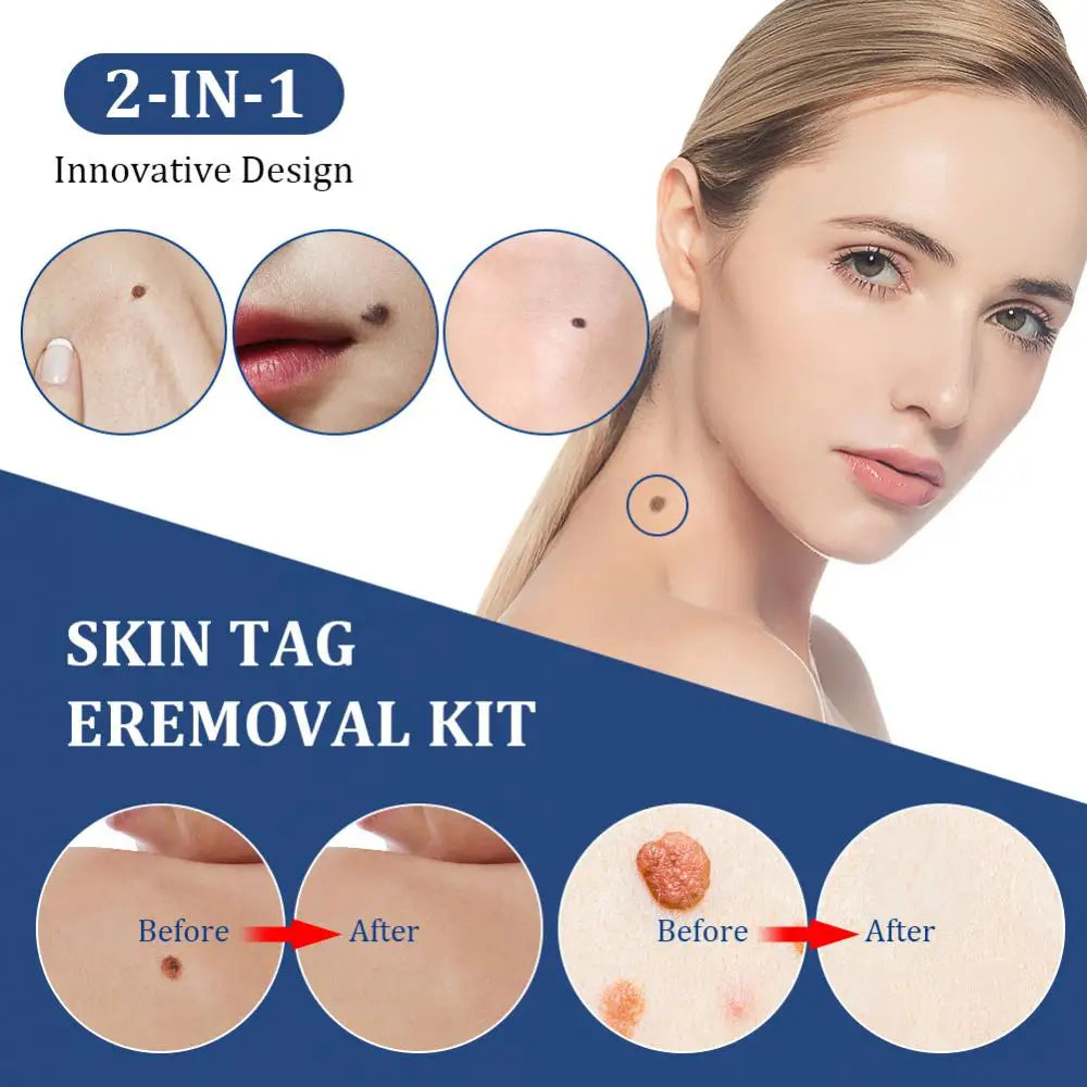 2 IN 1 AUTO SKIN TAG REMOVEL
