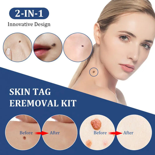2 IN 1 AUTO SKIN TAG REMOVEL