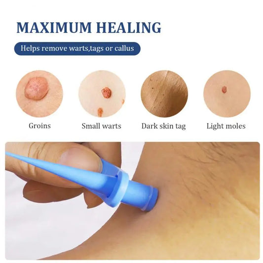 2 IN 1 AUTO SKIN TAG REMOVEL